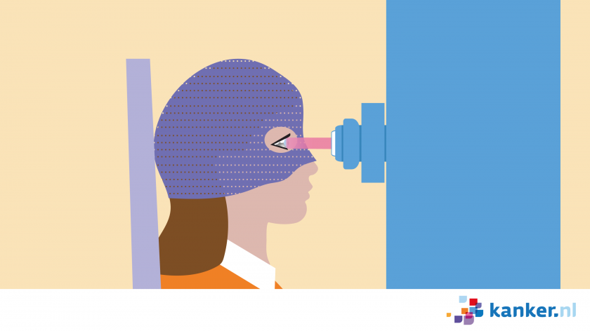 Bij protonentherapie bij oogmelanoom krijg je een frame met masker om je hoofd in de juiste positie te houden. 