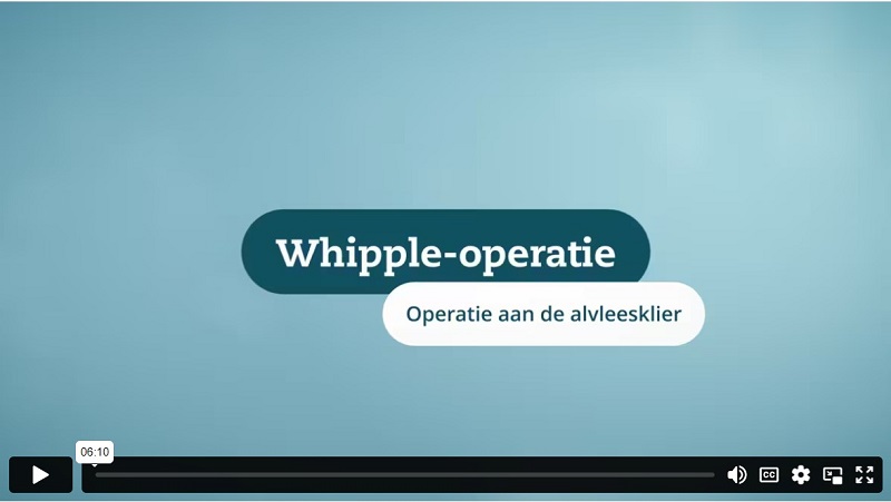 Afbeelding video Whipple-operatie