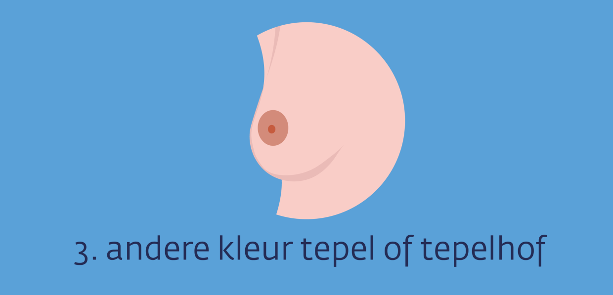 Ziekte Van Paget Van De Borst Kanker nl Ziekte Van Paget Van De Borst Kanker nl