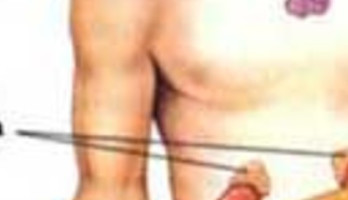 Thymus of Zwezerikkanker . Mijn ervaringen...