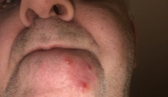 Hoe het allemaal begon