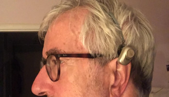 Ervaringen met gehoorapparaat na operatie 