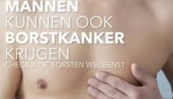 Mannen kunnen dus “ook” borstkanker krijgen…