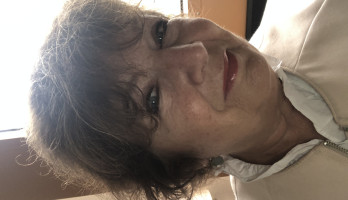 Deze foto is een maand geleden gemaakt,heb weer haar!