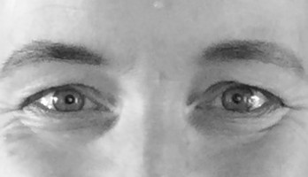 Mijn ogen tijdens chemo