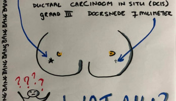 tekening van de 2 soorten borstkanker die in september '19 bij me werden vastgesteld.