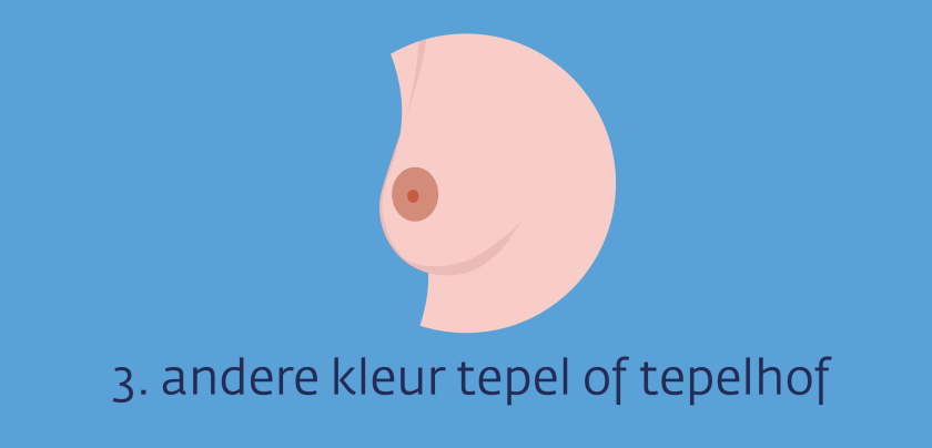 Ziekte Van Paget Van De Borst Kanker nl Ziekte Van Paget Van De Borst Kanker nl