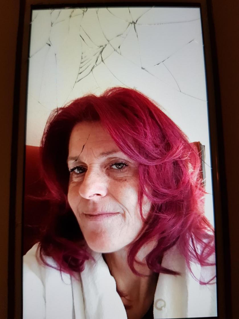Op deze foto zat ik midden in de behandeling van imuun therapie