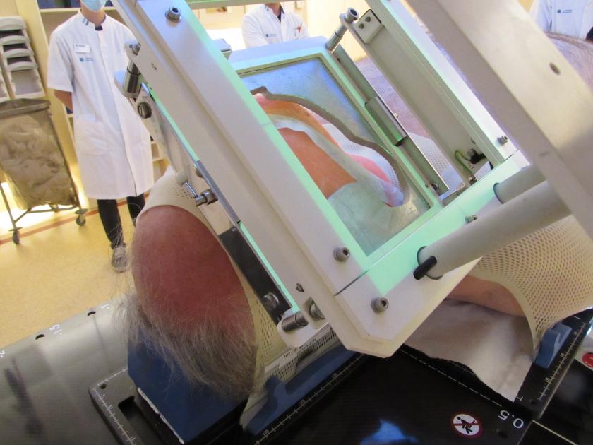 bestraling van een deel van het gezicht