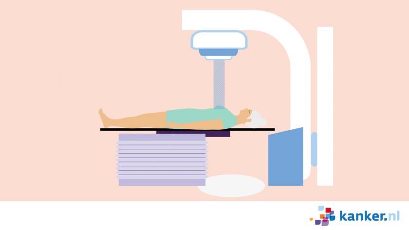 Bestraling van de borst kan nodig zijn bij borstkanker of longkanker.