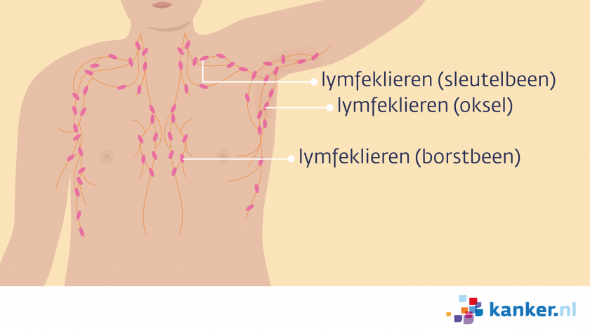 Illustratie lymfeklieren in het gebied rond de borst bij mannen
