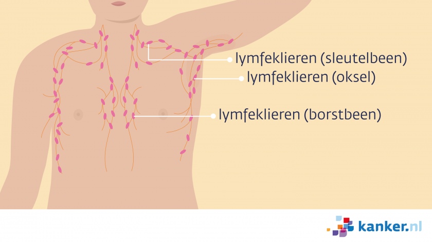 Lymfeklieren rond de borst bij mannen zitten in de oksel, bij het schouderblad en het borstbeen