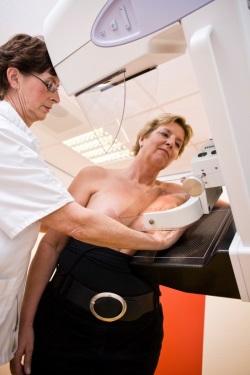 Mammografie van opzij