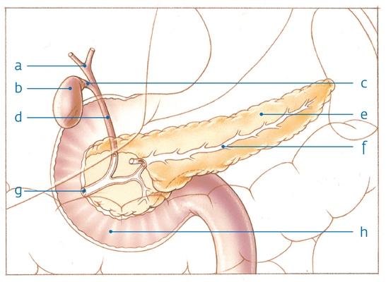 Tumor In De Alvleesklier Men 1 Syndroom