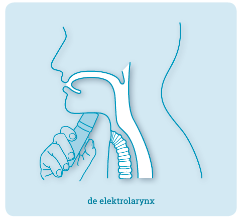 Elektrolarynx