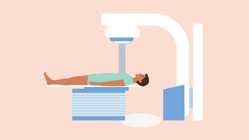 illustratie van een man die op zijn rug ligt onder een bestralingstoestel terwijl zijn borst wordt bestraald.
