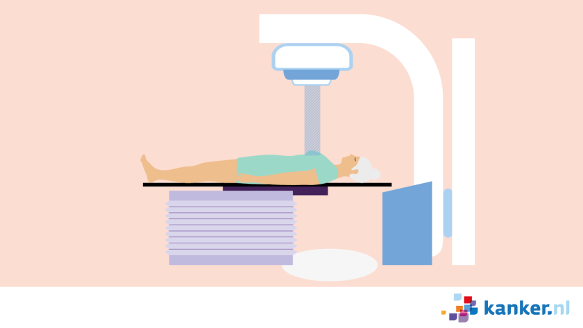 Een vrouw ligt op haar rug onder een bestralingsapparaat terwijl haar borst wordt bestraald.