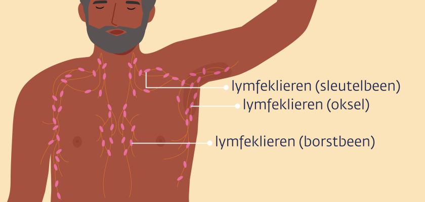 Lymfeklieren rond de borst bij mannen zitten in de oksel, bij het schouderblad en het borstbeen