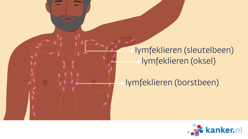 Lymfeklieren rond de borst bij mannen zitten in de oksel, bij het schouderblad en het borstbeen