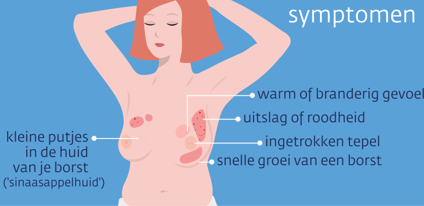 Inflammatoire borstkanker kan verschillende vormen hebben, zoals kleine putjes in de huid, uitslag of roodheid, of een ingetrokken tepel.