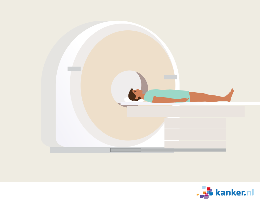 illustratie van een man die op zijn rug ligt en de ronde opening van de ct-scanner ingeschoven wordt