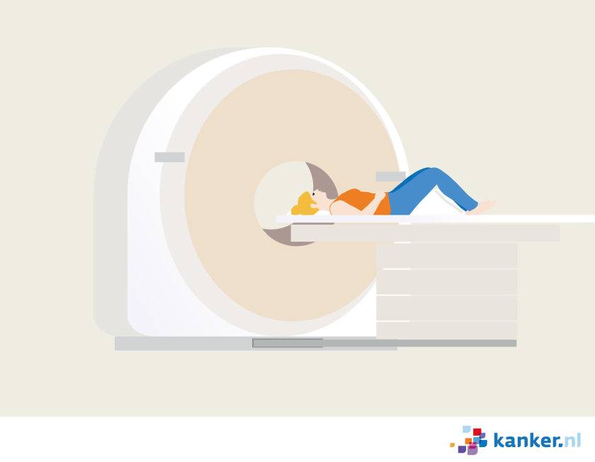 illustratie van een vrouw die op haar rug ligt en de ronde opening van de ct-scanner ingeschoven wordt