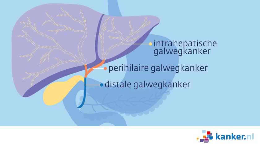 Er zijn drie verschillende soorten galwegkanker