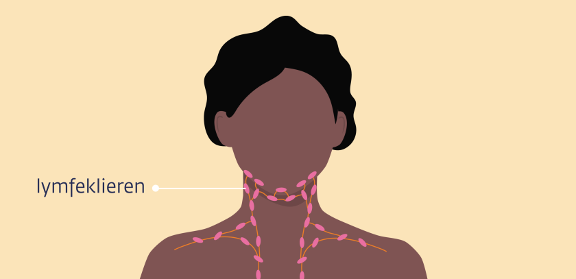 De lymfeklieren in de hals lopen van het kaakgebied tot aan de sleutelbeenderen en het borstbeen.