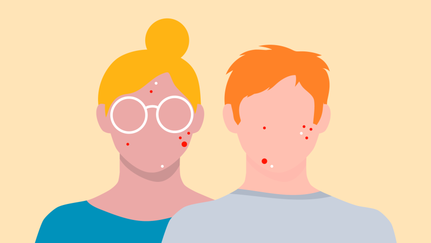 illustratie van 2 tieners met puistjes in het gezicht