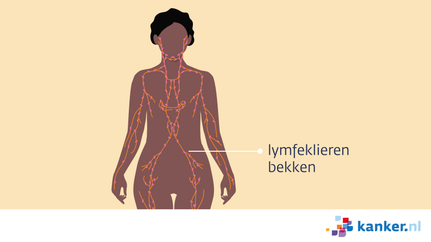 Op verschillende plekken in het lichaam zitten lymfeklieren, onder andere in het bekken.