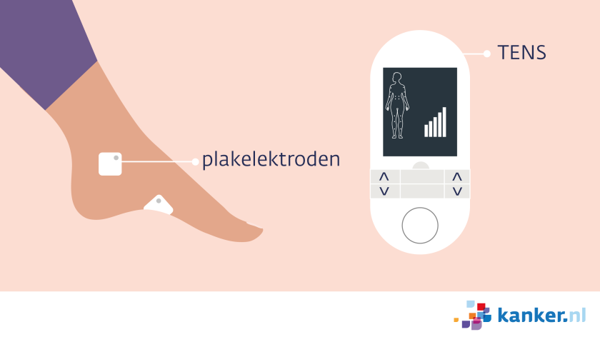 Bij een TENS-behandeling krijg je elektrische stroompjes via 1 of 2 elektrodes op je huid en een apparaatje dat je bij je draagt.