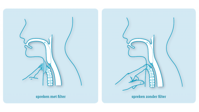 Stemprothese met en zonder filter