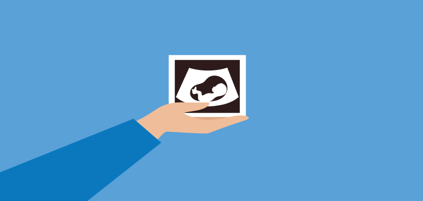 illustratie van een uitgestrekte arm met hand die een echofoto laat zien