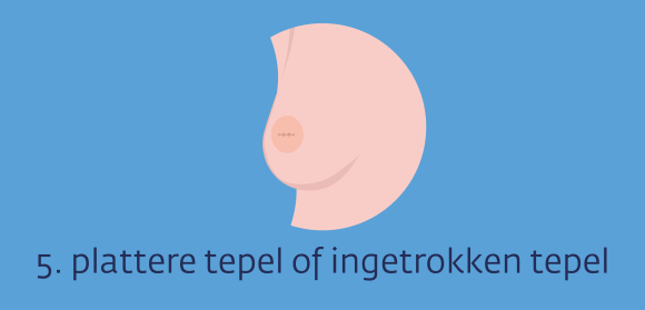 Ziekte Van Paget Van De Borst Kanker nl Ziekte Van Paget Van De Borst Kanker nl