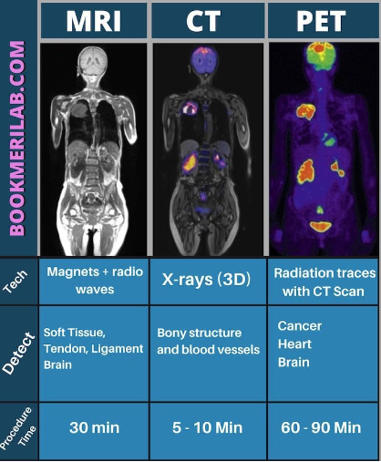 Diagnose longkanker (v) door Anja Drent | Kanker.nl