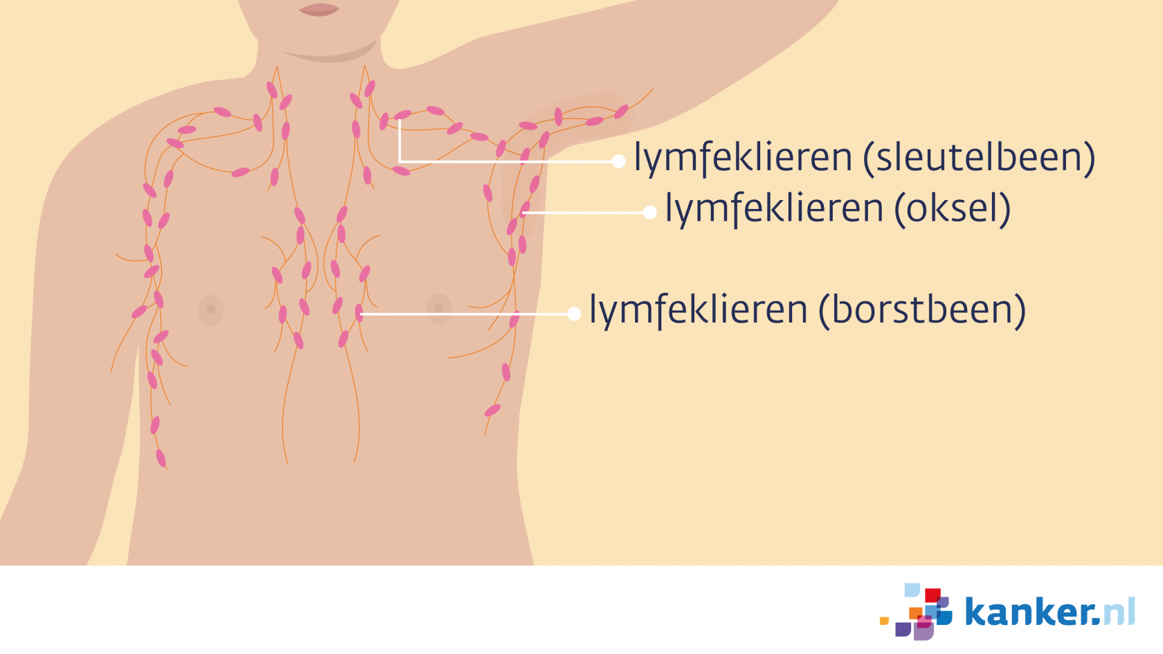 Perioperatieve periode Stimulans Schuine streep Informatie over de borst van de man | Kanker.nl