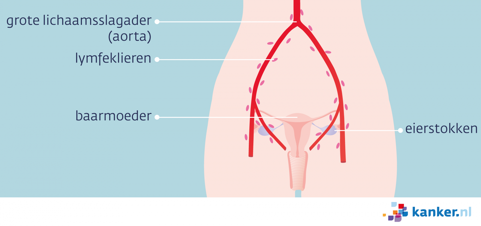 Uitzaaiingen Van Eierstokkanker Ovariumcarcinoom