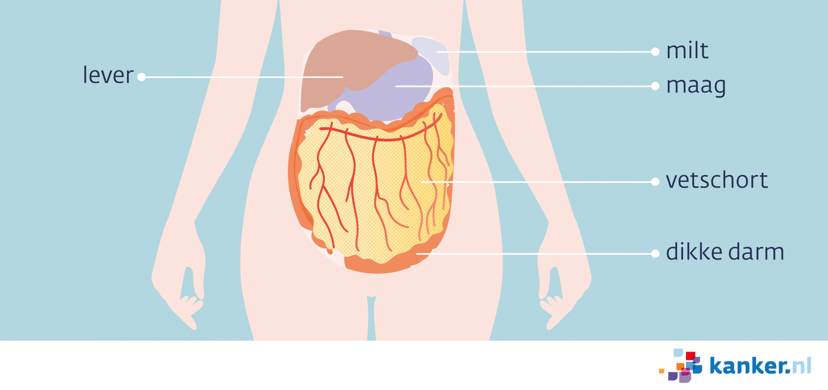 Uitzaaiingen Van Eierstokkanker Ovariumcarcinoom