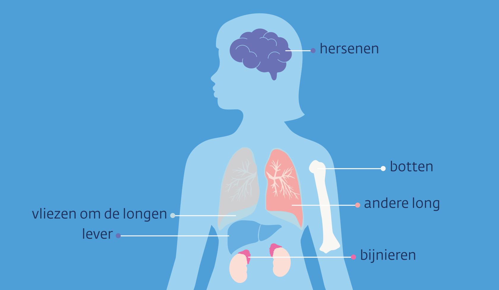 Uitzaaiingen bij longkanker | kanker.nl