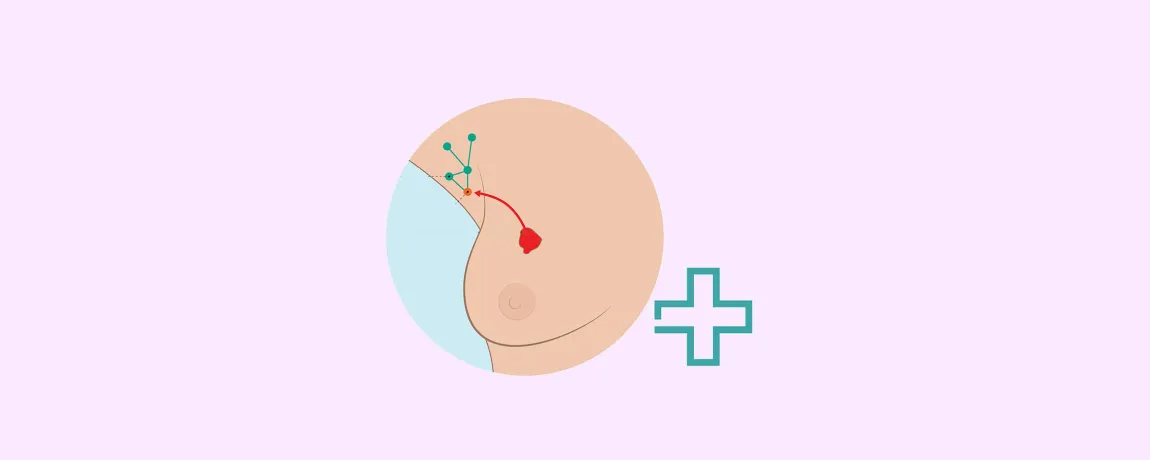 Patientplus Aanvullende behandeling A 