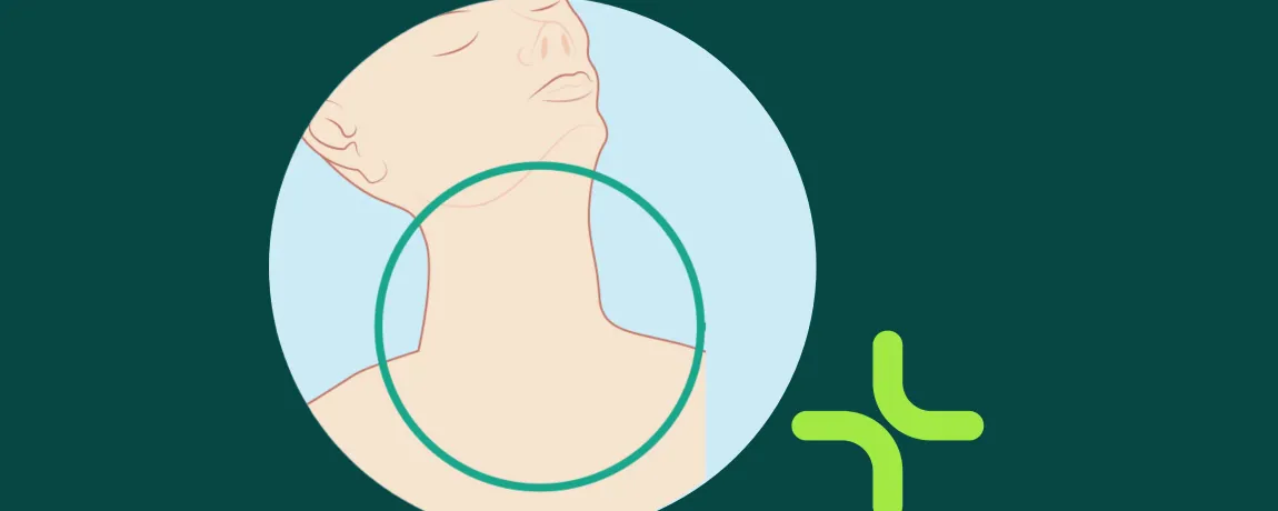 Schildklierkanker met uitzaaiing: systeemtherapie Sorafenib